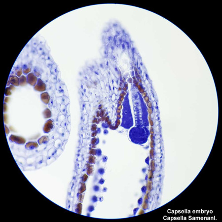 bresser-researcher-bino-40-1000x-professional-microscope_5