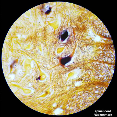 bresser-researcher-bino-40-1000x-professional-microscope_6