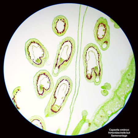 bresser-science-tfm-201-bino-professional-microscope_4